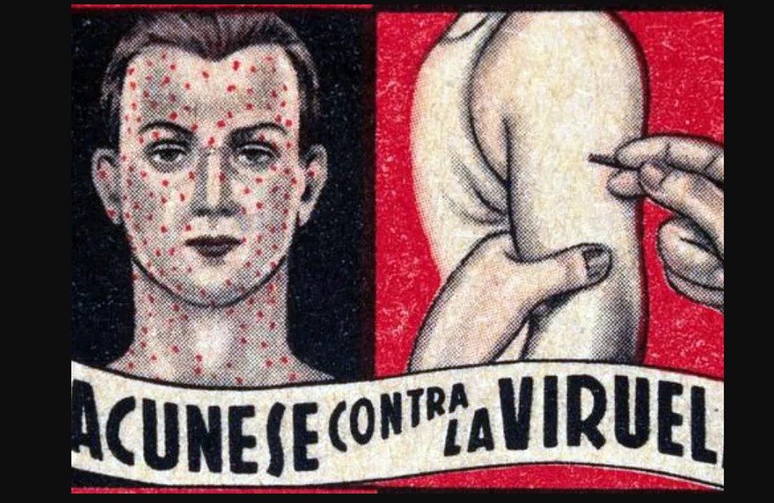 Desde el siglo XVI, las epidemias de viruela se presentaron ininterrumpidamente en México cobrando la vida de millones hasta finales del siglo XIX, cuando comenzó a aplicarse la vacuna contra esta enfermedad. Imagen recuperada de: DGCS-UNAM.